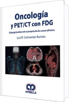 Oncología y PET/CT con FDG - Colmenter - 978-958-8950-85-3