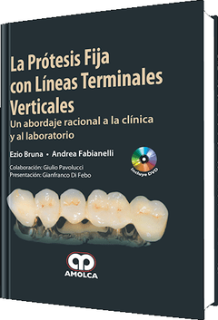La Prótesis Fija con Líneas Terminales Verticales + DVD - Bruna - 978-958-57141-6-8
