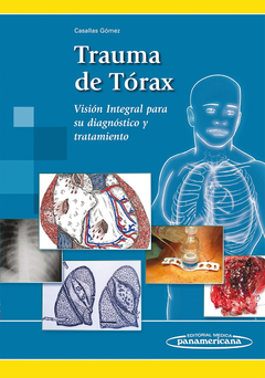 Trauma de Tórax - Casallas Gómez - 9789588443706