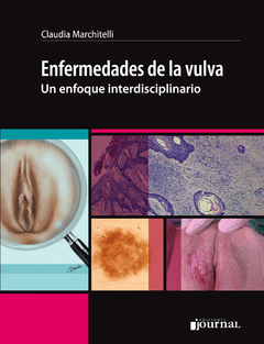 Enfermedades de la vulva: Un enfoque interdisciplinario - Marchitelli -  ISBN:  9789873954559 