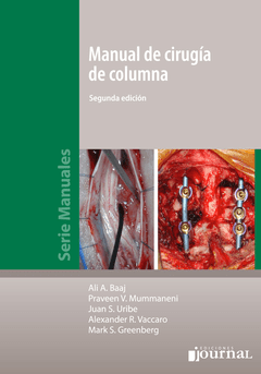 Manual de cirugía de columna - Baaj - ISBN:  9789873954535 