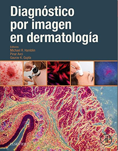 Diagnóstico por imagen en dermatología - Hamblin - Isbn: 9788491131762