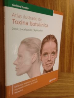 ATLAS ILUSTRADO DE TOXINA BOTULÍNICA - Sattler - ISBN: 9789871259861 