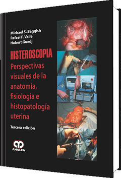 Histeroscopia Perspec. Visuales de Anat. Fisio. e Histopat. Uterina - Baggish - 978-958-8473-20-8
