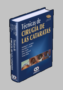 Técnicas de Cirugía de las Cataratas - Sachdev - ISBN:978-958-8328-57-7