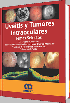 Uveítis y Tumores Intraoculares - Arévalo - ISBN: 978-958-8328-43-0