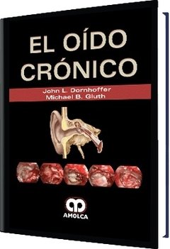 El Oído Crónico - Dornhoffer - 978-958-5426-34-4