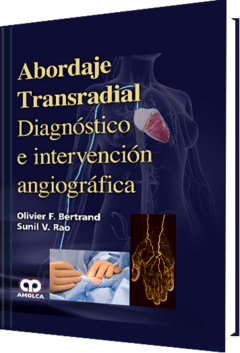 Abordaje Transradial Diagnóstico e intervención angiográfica - 978-958-8950-54-9