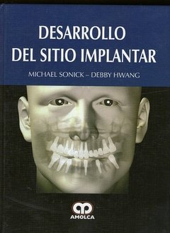 Desarrollo del Sitio Implantar