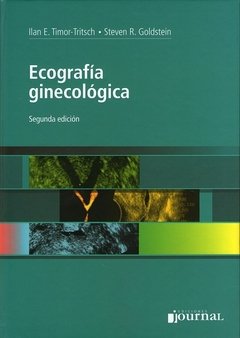 ECOGRAFÍA GINECOLÓGICA