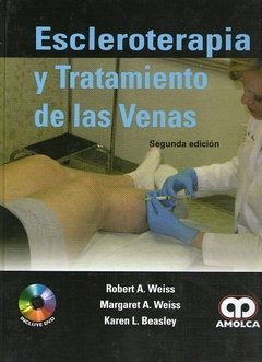 ESCLEROTERAPIA Y TRATAMIENTO DE LAS VENAS