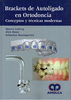 Brackets de Autoligado en Ortodoncia. Conceptos y Técnicas Modernas