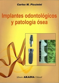 IMPLANTES ODONTOLOGICOS Y PATOLOGIA OSEA