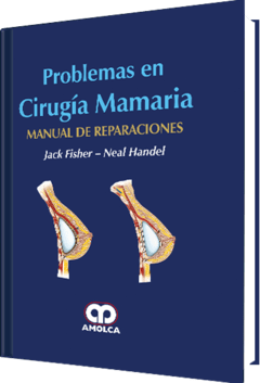 Problemas en Cirugía Mamaria Manual de reparaciones - Fisher - 978-958-8950-47-1