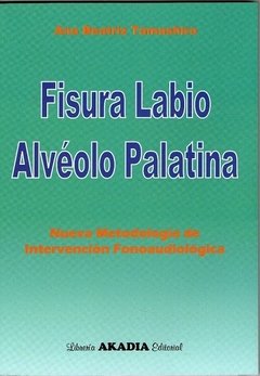 FISURA LABIO ALVEOLO PALATINA