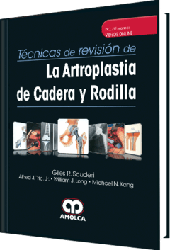 Técnicas de Revisión de la Artroplastia de Cadera y Rodilla - 978-958-5426-09-2