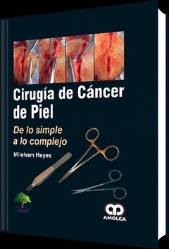 CIRUGIA DE CANCER DE PIEL