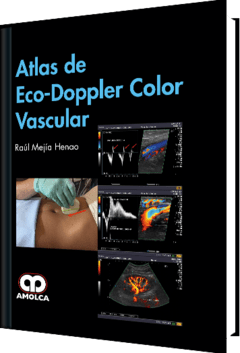 Atlas de Eco-Doppler Color Vascular - Mejía Henao - 978-958-8950-79-2