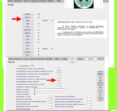 Evaluación Neuropsicologica SOFTWARE COMPLETO