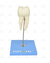 Dente Molar Inferior c/ Raiz Dupla em 3 Partes c/ Cárie, 8x o Tamanho Real Aprox. - SD-5059/E - Sdorf Scientific