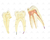 Dente Molar Superior c/ Raiz Tripla em 3 Partes, 8x o Tamanho Real Aprox. - SD-5059/F - Sdorf Scientific - comprar online