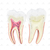 Dentes em 6 Partes (Incisivo, Canino e Molar) - SD-5059/H - Sdorf Scientific - comprar online