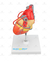 Modelo Patológico do Coração com Pontagem Coronária - SD-5215 - Sdorf Scientific - comprar online