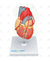 Modelo Patológico do Coração com Pontagem Coronária - SD-5215 - Sdorf Scientific