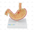 Modelo Patológico do Estômago - SD-5207 - Sdorf Scientific - comprar online