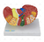 Modelo Patológico do Fígado e Vesícula Biliar - SD-5206 - Sdorf Scientific