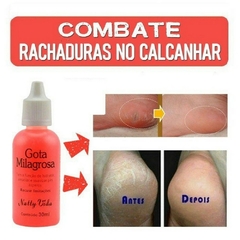 Gota Milagrosa Para Pés Combate Rachadura Ressecamento 30ml - SHOP OFERTA