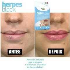 Imagem do Herpes Block Adesivo para Herpes Labial