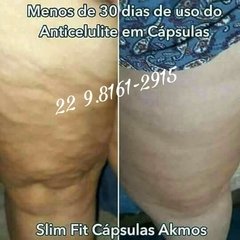 Kit adeus celulites com slim fit cápsulas e creme redutor na internet