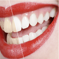 Estética – Dental en internet