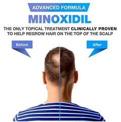 Minoxidil Men 3 frascos 60g Foam Espuma - comprar online